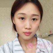 重庆五洲医疗美容隆鼻怎么样？2020价格表一览+隆鼻真人案例效果反馈