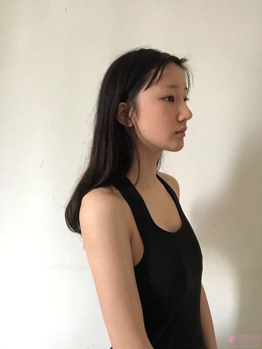 南京美莱整形夏建军医生隆胸怎么样？2020价格表曝光？