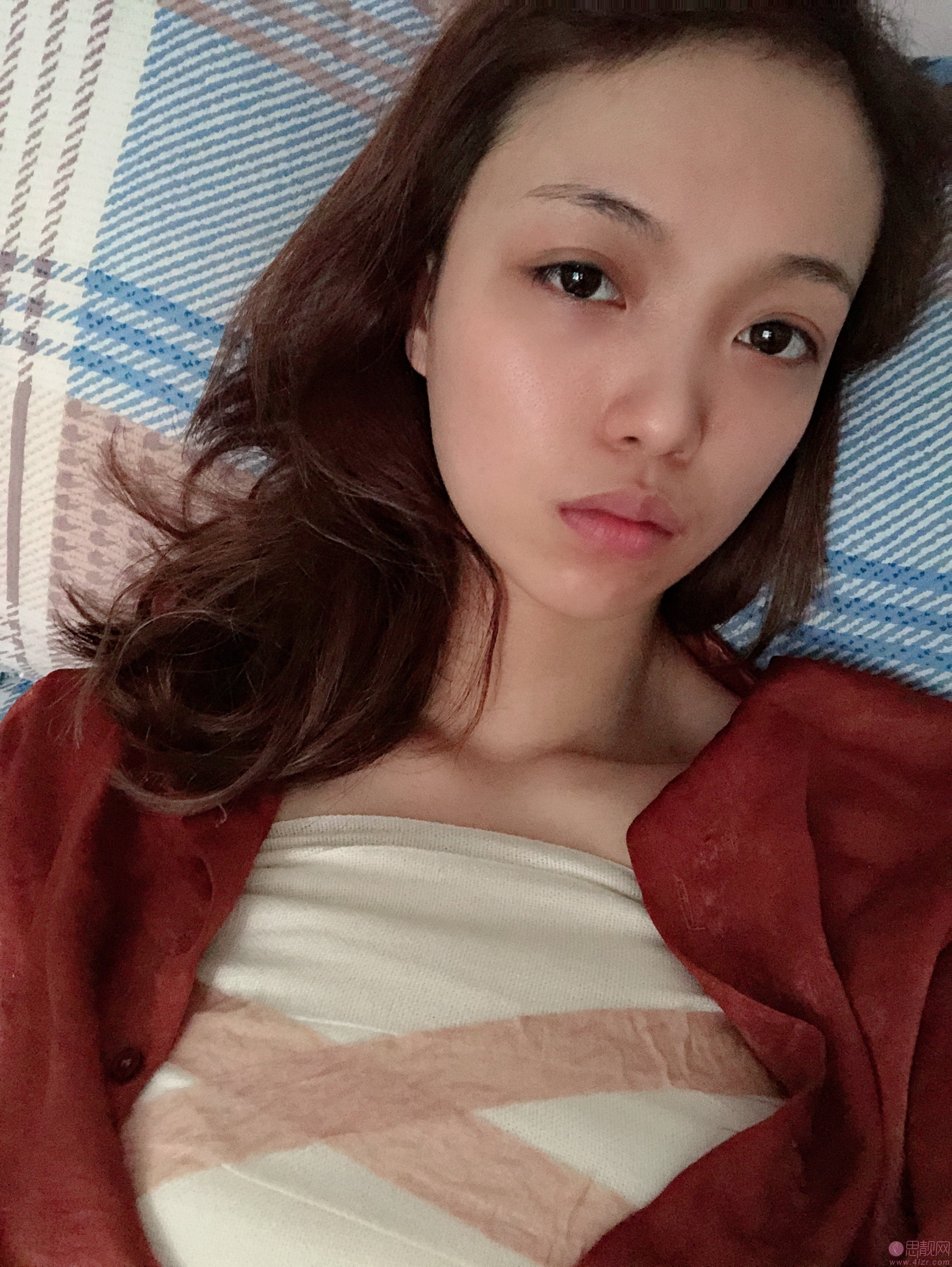 南京美莱整形夏建军医生隆胸怎么样？2020价格表曝光？