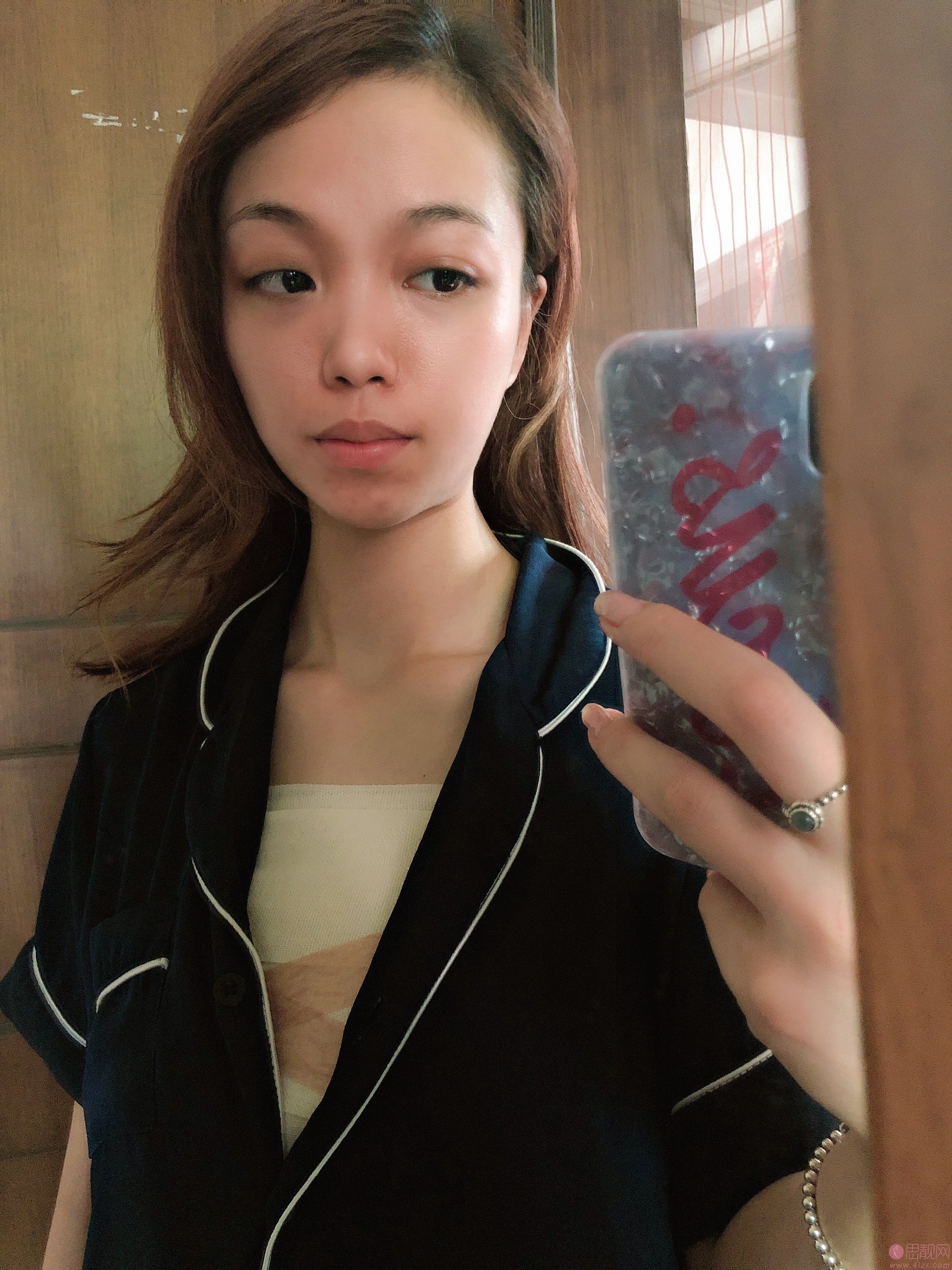 南京美莱整形夏建军医生隆胸怎么样？2020价格表曝光？