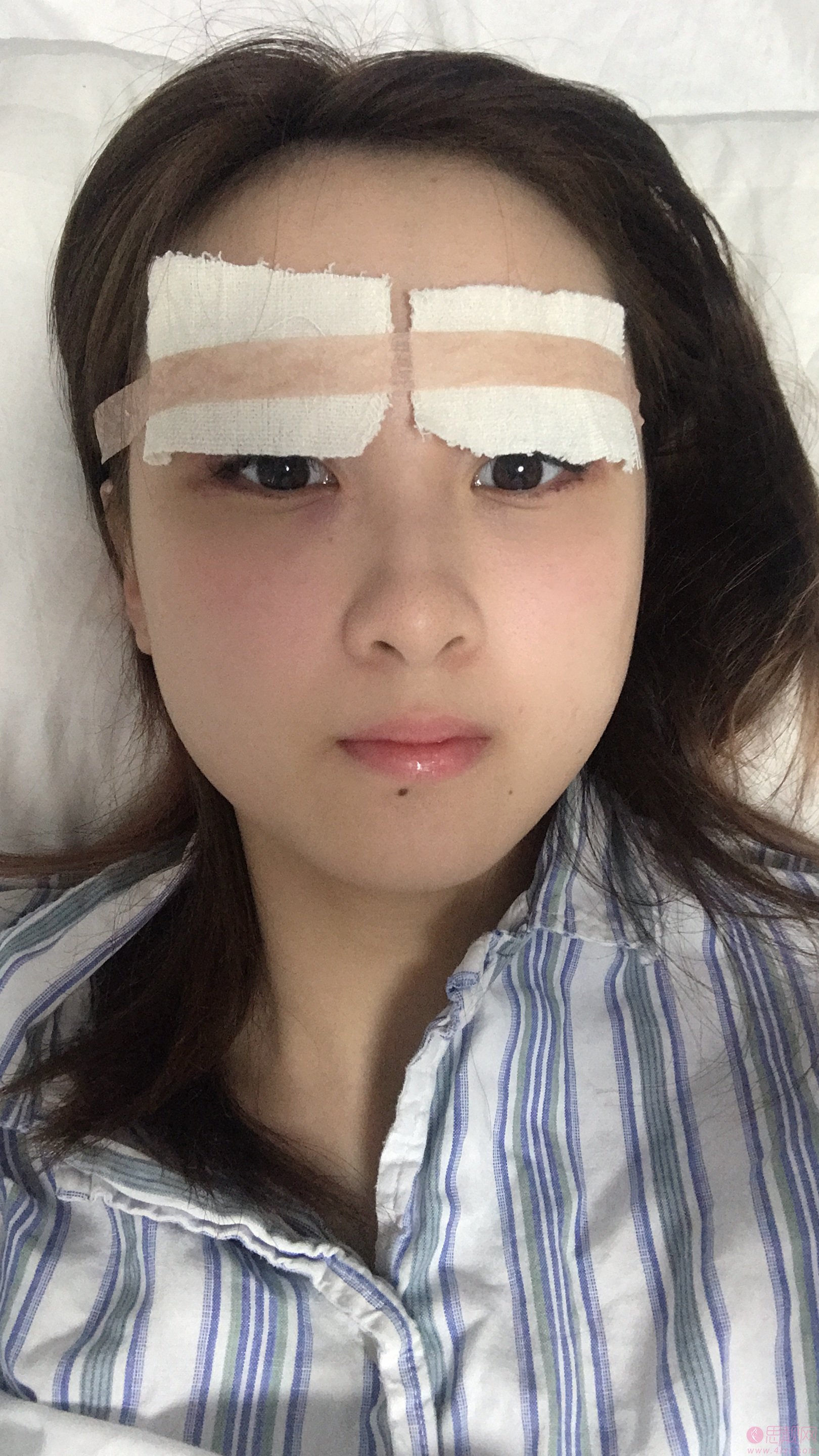 南京医科大学友谊整形外科医院扬州医疗美容苗瑞龙医生做双眼皮怎么样？2020价格表曝光