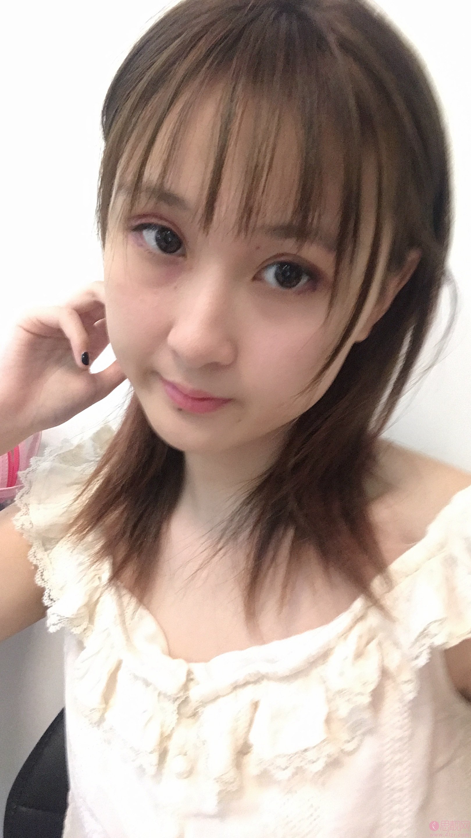 南京医科大学友谊整形外科医院扬州医疗美容苗瑞龙医生做双眼皮怎么样？2020价格表曝光