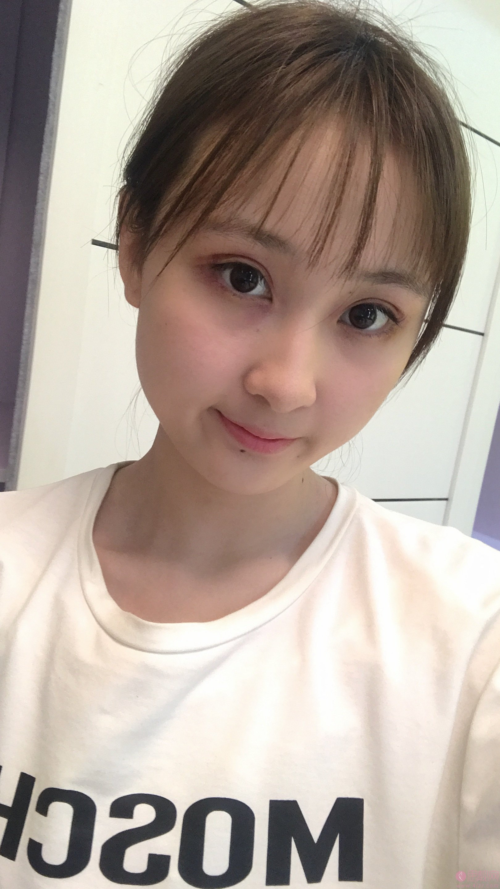 南京医科大学友谊整形外科医院扬州医疗美容苗瑞龙医生做双眼皮怎么样？2020价格表曝光