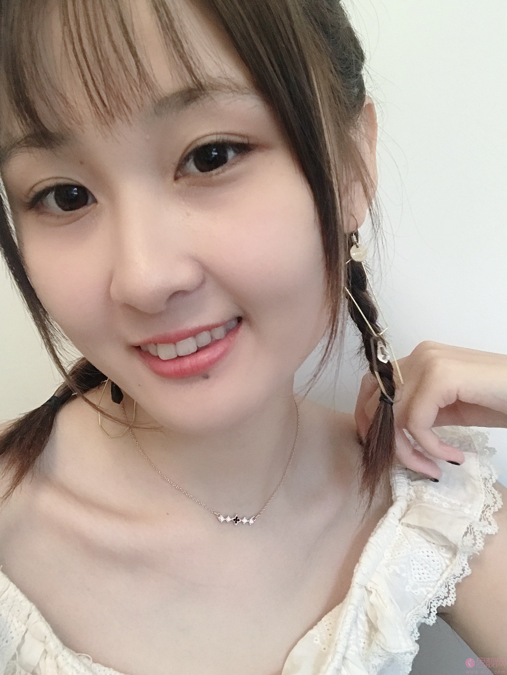 南京医科大学友谊整形外科医院扬州医疗美容苗瑞龙医生做双眼皮怎么样？2020价格表曝光