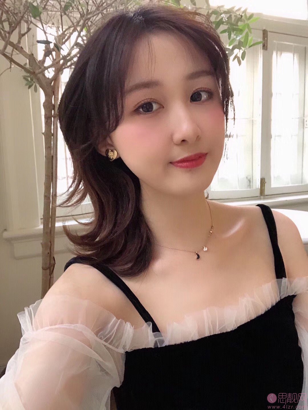 南京医科大学友谊整形外科医院扬州医疗美容苗瑞龙医生做双眼皮怎么样？2020价格表曝光