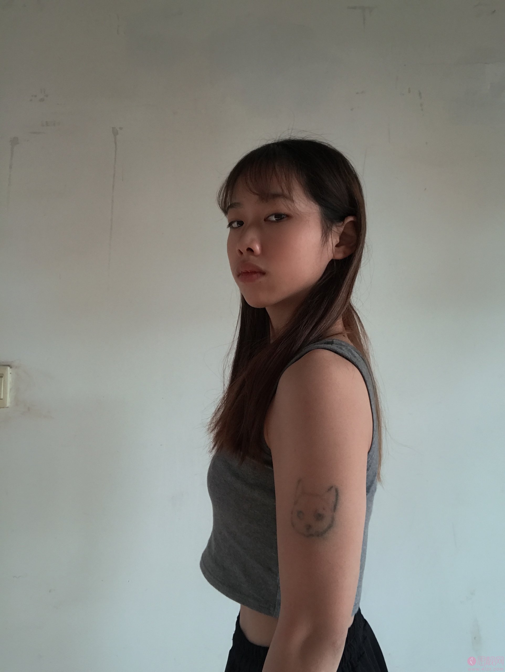 武汉同济医院整形外科做吸脂手术怎么样？2020价格表一览+吸脂真人案例分享
