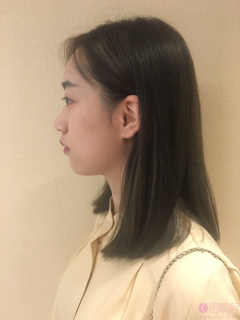 武汉同济医院整形美容外科怎样?2020价格表曝光+隆鼻真人案例分享