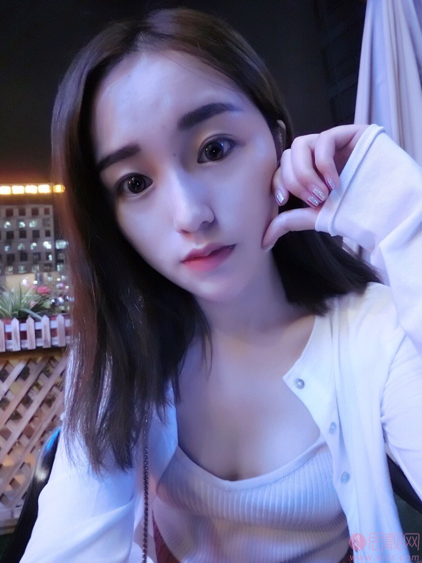 武汉同济医院整形美容外科怎样?2020价格表曝光+隆鼻真人案例分享