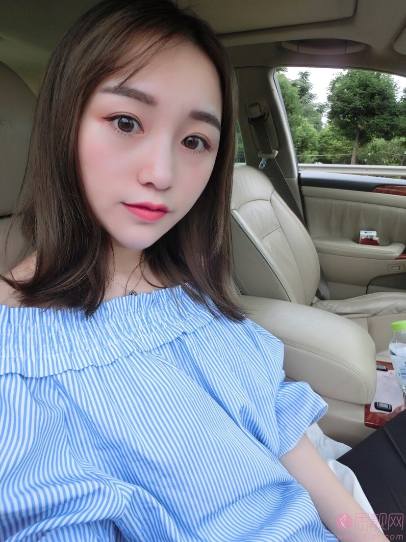 武汉同济医院整形美容外科怎样?2020价格表曝光+隆鼻真人案例分享