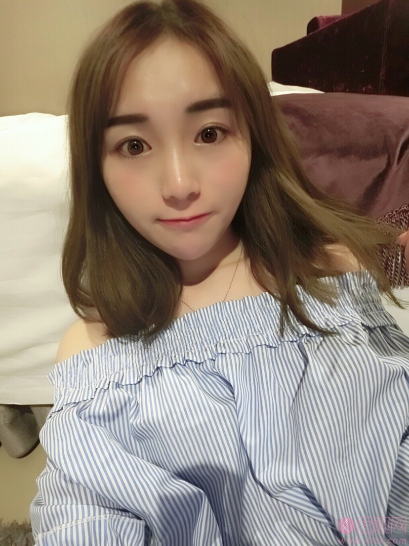 武汉同济医院整形美容外科怎样?2020价格表曝光+隆鼻真人案例分享