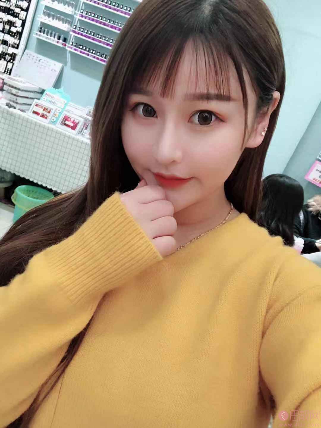 武汉同济医院整形美容科隆鼻好不好？附隆鼻真人案例效果反馈
