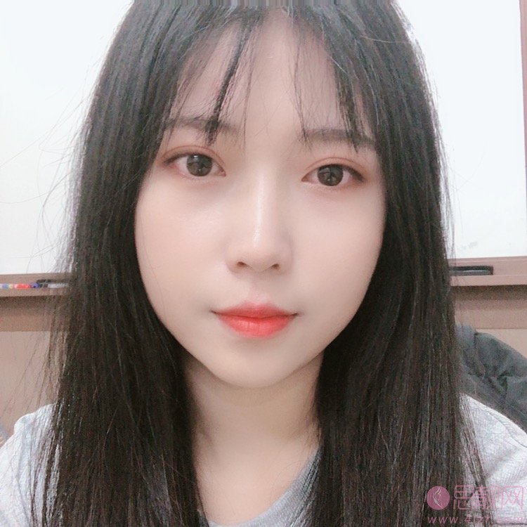  北大深圳医院整形科做双眼皮手术怎么样？附双眼皮真人案例一览及2020价格表曝光