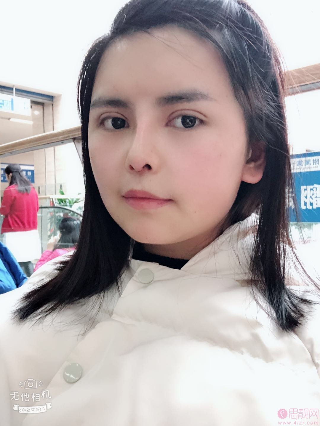 呼和浩特五洲整形医院王焕医生隆鼻好不好？2020价格表曝光
