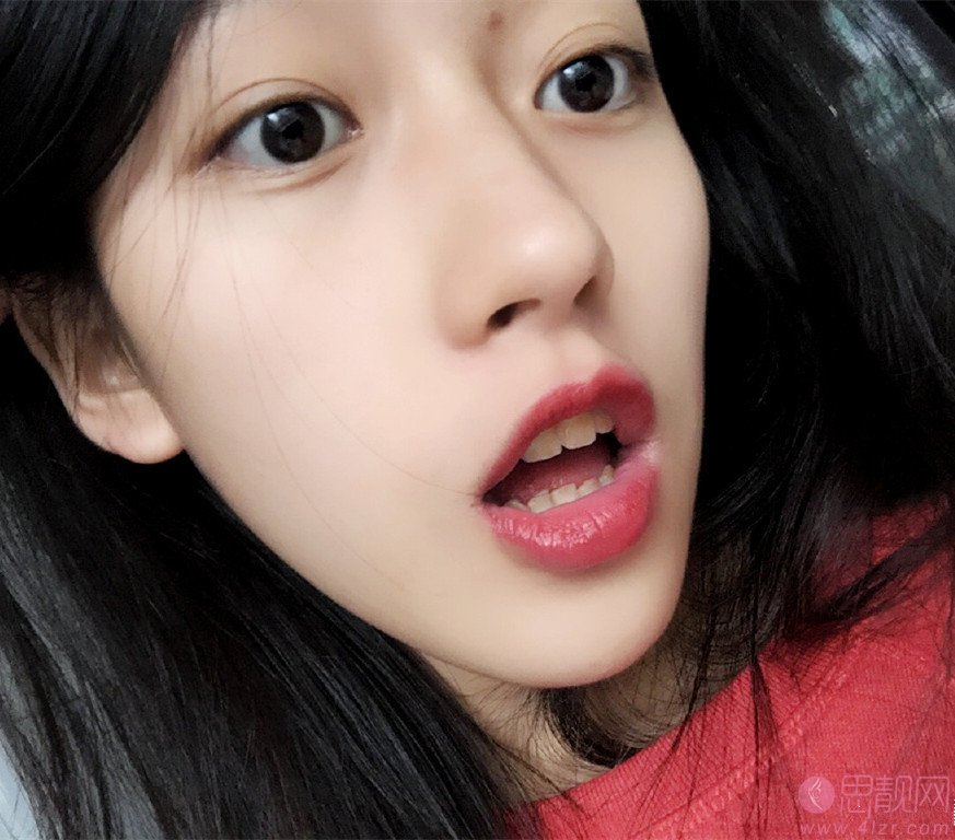 大众口腔(南湖花园门诊)冷光美白怎么样?2020价格表曝光+冷光美白术后真人反馈