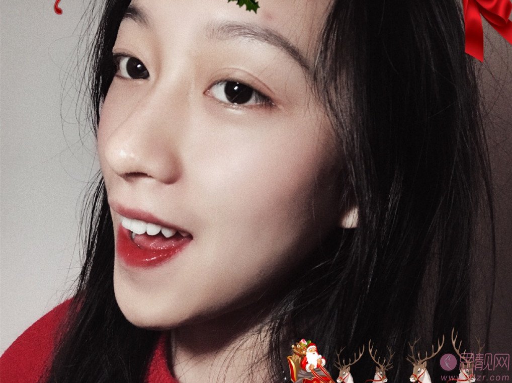 大众口腔(南湖花园门诊)冷光美白怎么样?2020价格表曝光+冷光美白术后真人反馈