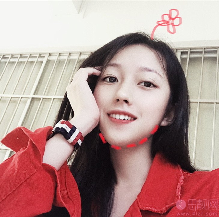 大众口腔(南湖花园门诊)冷光美白怎么样?2020价格表曝光+冷光美白术后真人反馈