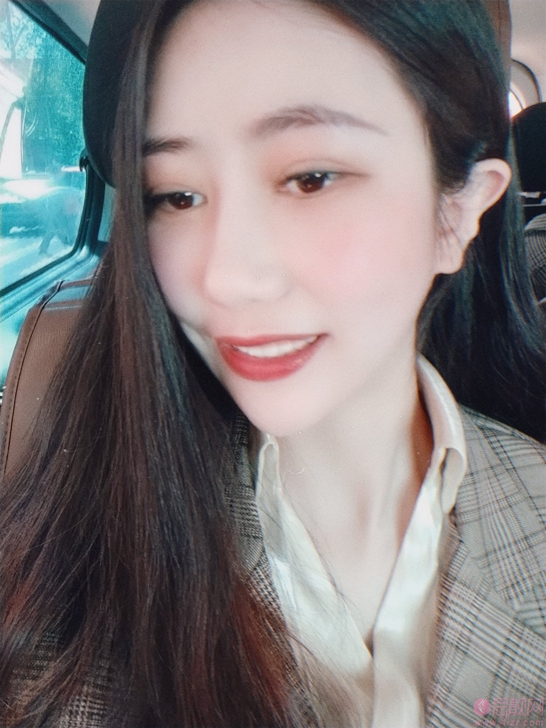上海恒愿齿科美白牙齿好不好,附牙齿美白真人案例一览及2020价格表曝光