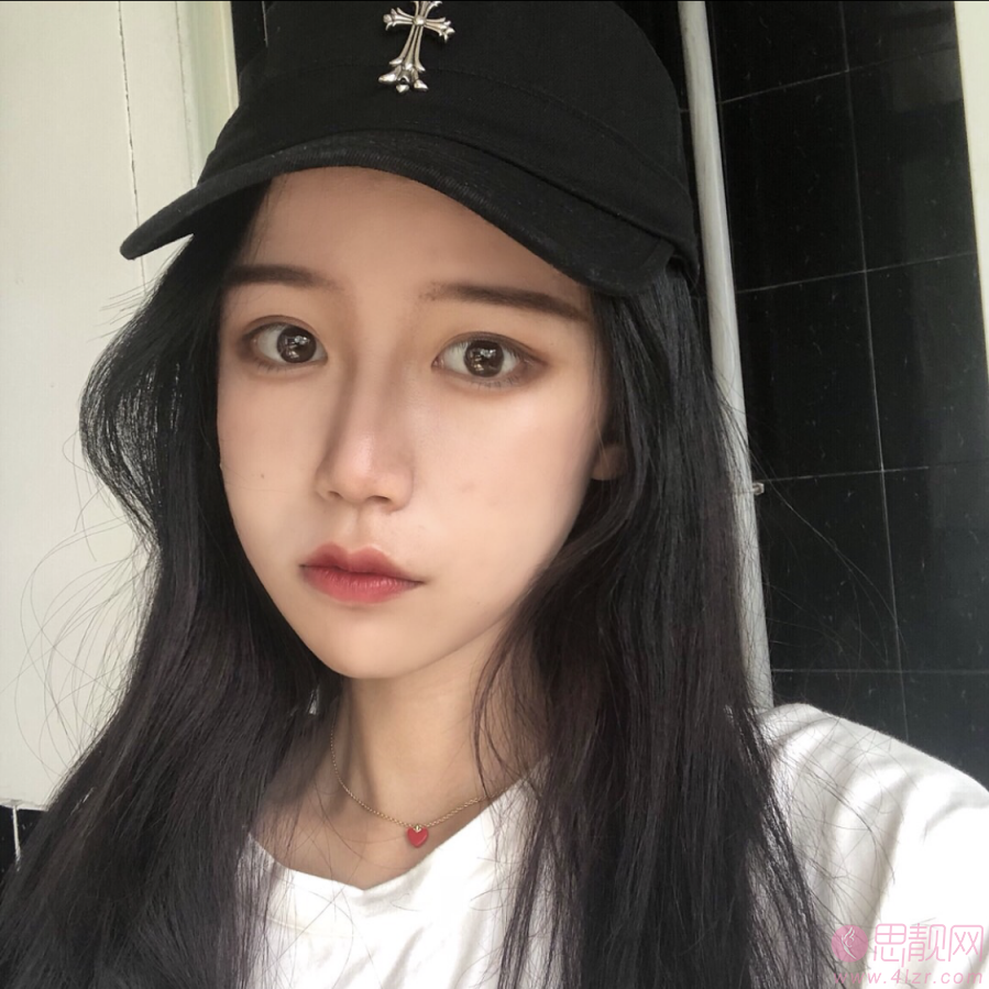 四川绵阳朗睿整形美容医院杨俊隆鼻怎么样？2020价格表曝光+隆鼻真人案例一览