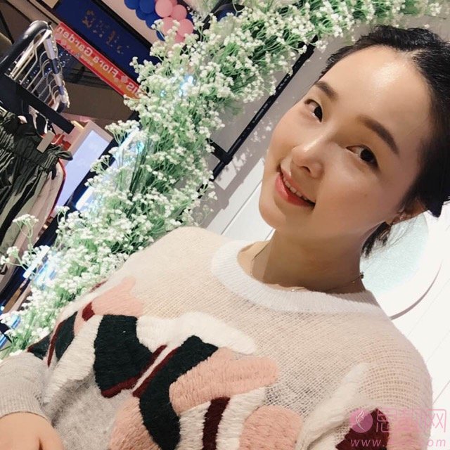 长沙美莱整形美容医院潘卫峰做鼻子怎么样？2020价格公布