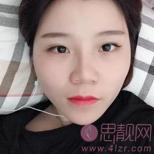 上海伊尔美港华医疗美容医院吕京陵医生做颧骨内推手术怎么样?2020价格表公布