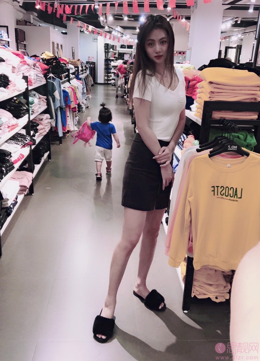 广东韩妃医疗美容医院吸脂瘦大腿怎么样?2020价格表公布+吸脂瘦大腿真人案例分享