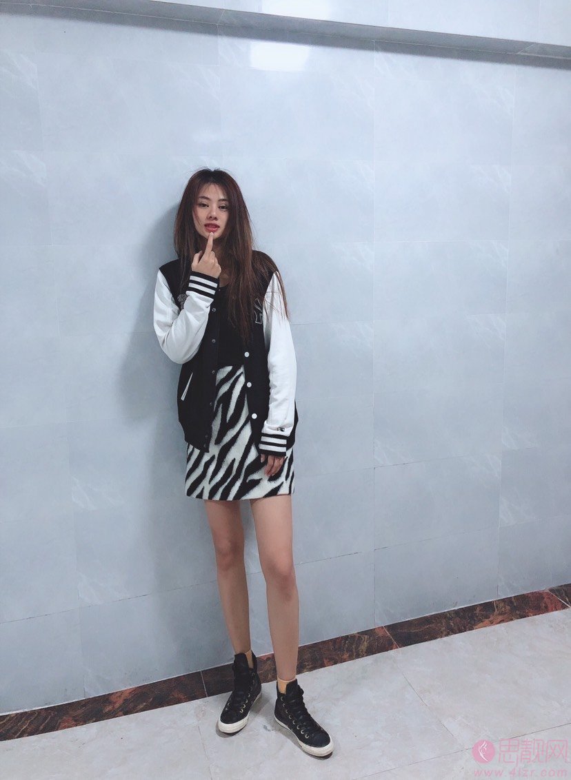 广东韩妃医疗美容医院吸脂瘦大腿怎么样?2020价格表公布+吸脂瘦大腿真人案例分享