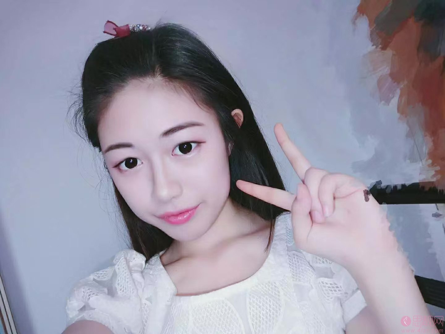 黑龙江艺星医疗美容医院王丽丹做双眼皮好不好？2020价格表公布+双眼皮术后真人案例一览