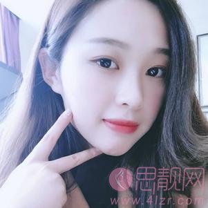 郑州美莱医疗美容医院张芳做双眼皮手术怎么样?2020价格表发布