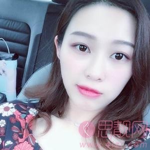 郑州美莱医疗美容医院张芳做双眼皮手术怎么样?2020价格表发布