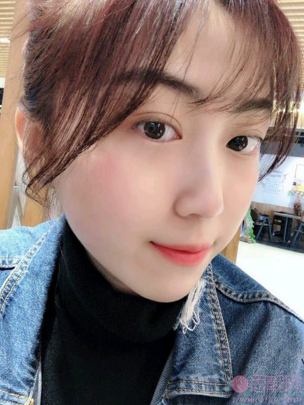 重庆艺星医疗美容医院朱家旭隆鼻好不好？2020价格表一览+隆鼻术后案例一览