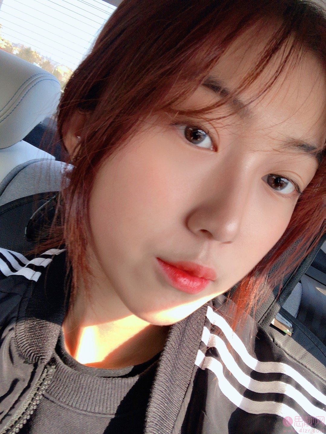 重庆艺星医疗美容医院朱家旭隆鼻好不好？2020价格表一览+隆鼻术后案例一览