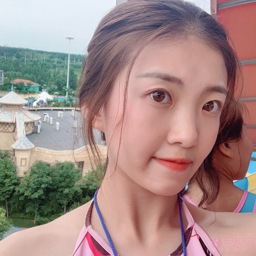 武汉五洲莱美整形外科医院严飞做双眼皮怎么样？2020价格表公布