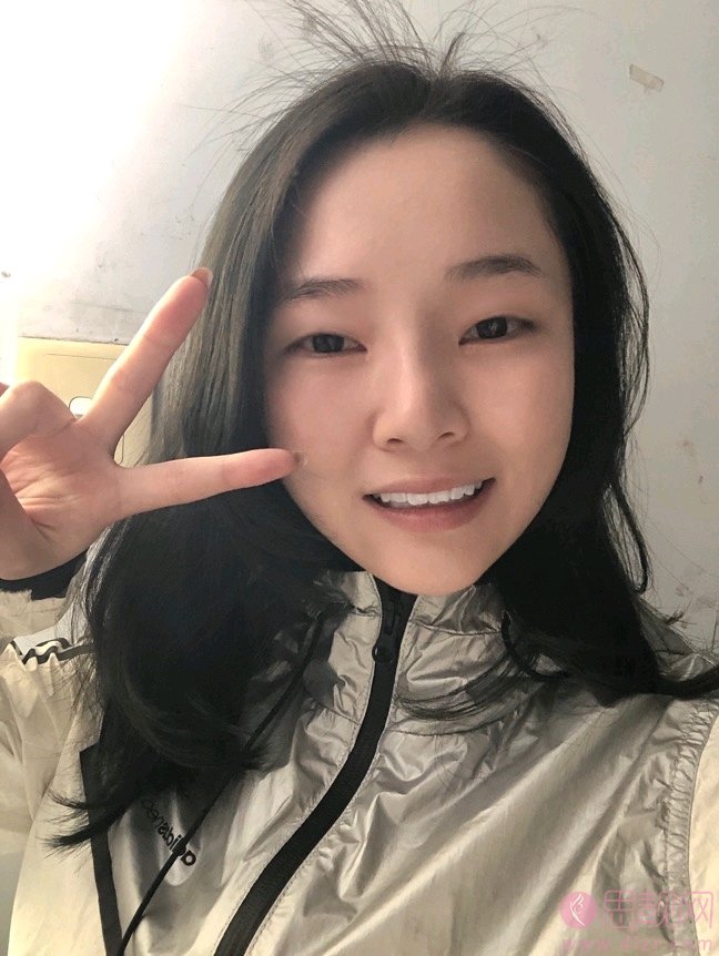 西安叶子整形美容医院朱健康做双眼皮手术好不好？2020价格表一览