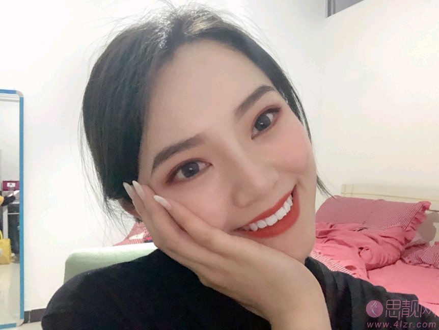 西安叶子整形美容医院朱健康做双眼皮手术好不好？2020价格表一览
