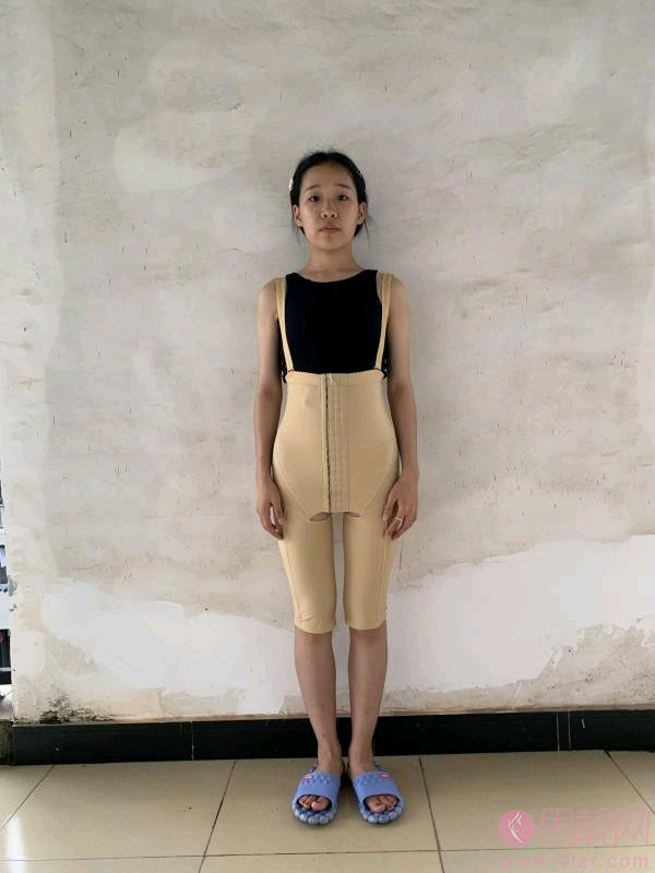 北京贵美汇医院靳玉彪吸脂怎么样？2020价格表发布+吸脂真人术后案例反馈
