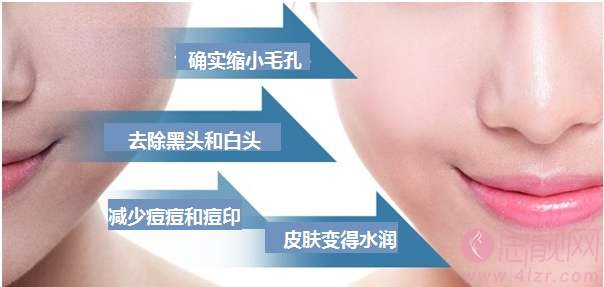 科普|黑脸娃娃能维持多长时间?及各大问题解决