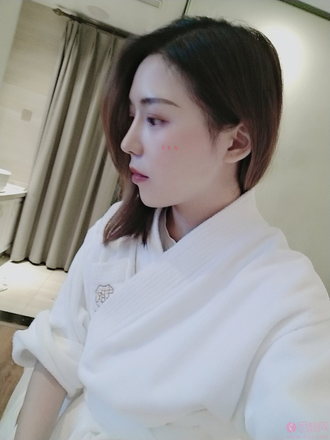 北医三院整形科李东隆鼻好不好？附隆鼻术后真人案例反馈
