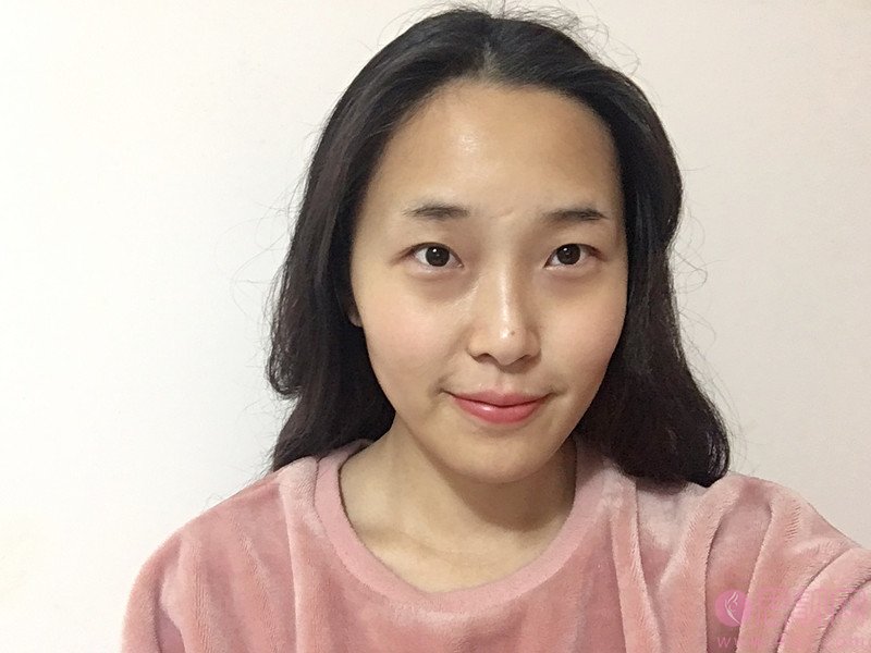 成都八大处医疗美容医院陈江庭做双眼皮好不好？2020价格表曝光