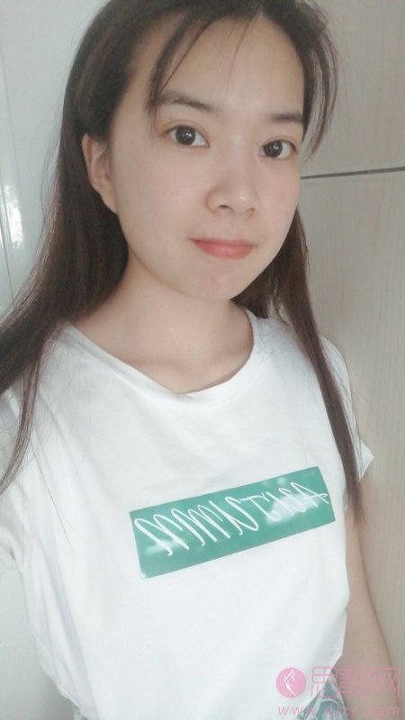 成都凡蜜医疗美容医院祛斑好不好？附祛斑术后真人案例分享及2020价格表发布