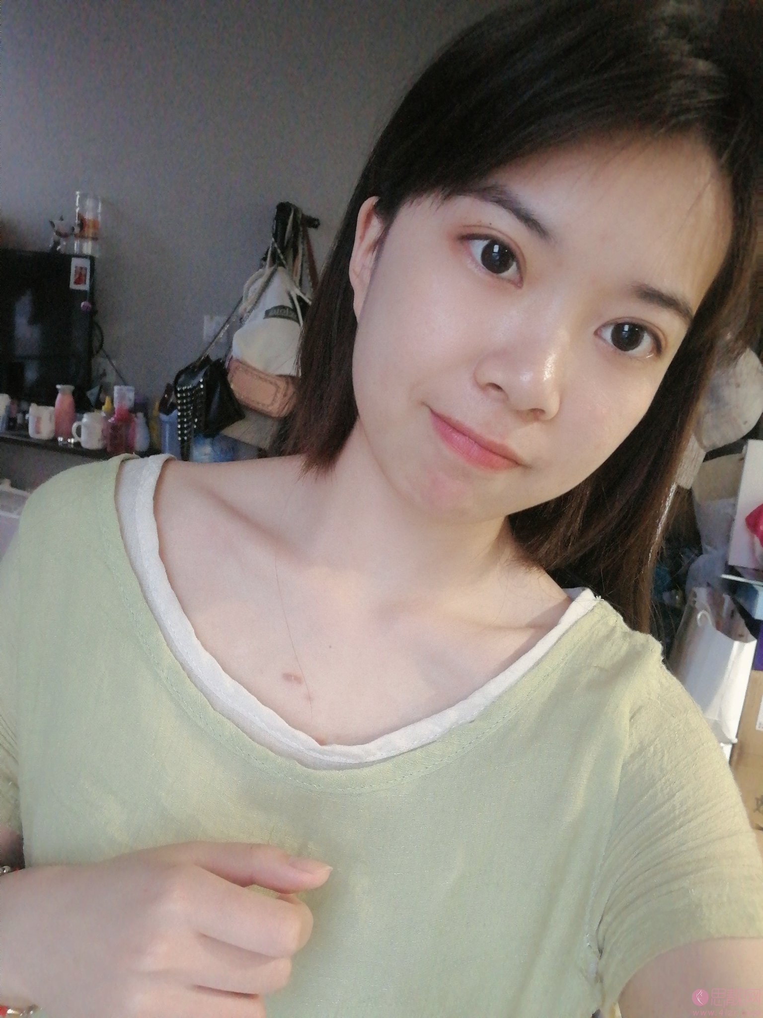 成都凡蜜医疗美容医院祛斑好不好？附祛斑术后真人案例分享及2020价格表发布