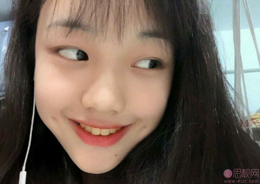 成都高新顶会口腔诊所医院美白牙齿好不好?附牙齿美白真人案例及2020价格表出炉