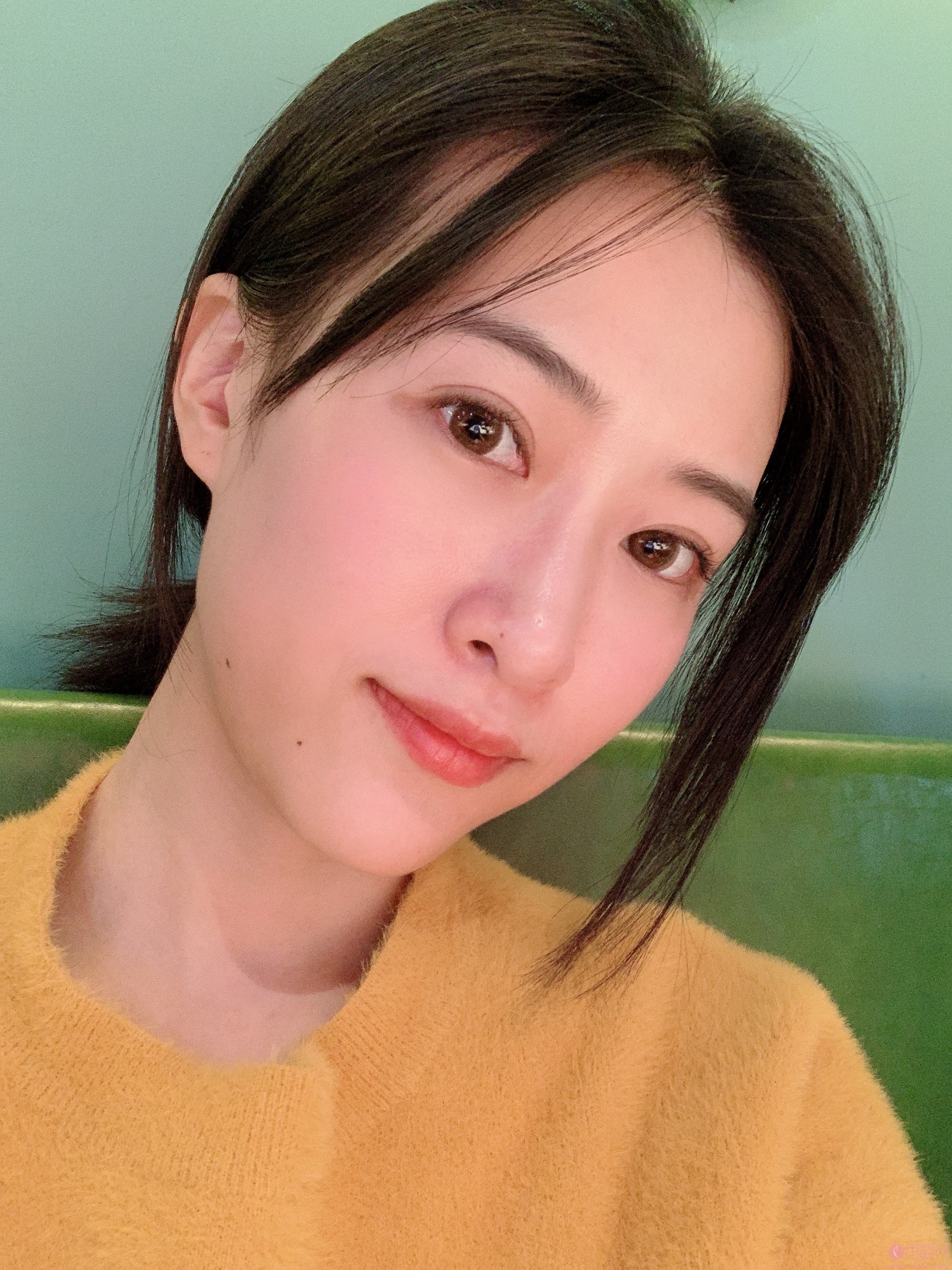 重庆郑荃丽格医疗美容激光祛眼袋好不好?2020价格表一览+祛眼袋术后案例分享