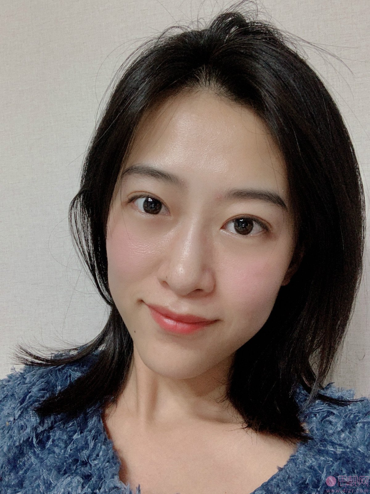 重庆郑荃丽格医疗美容激光祛眼袋好不好?2020价格表一览+祛眼袋术后案例分享