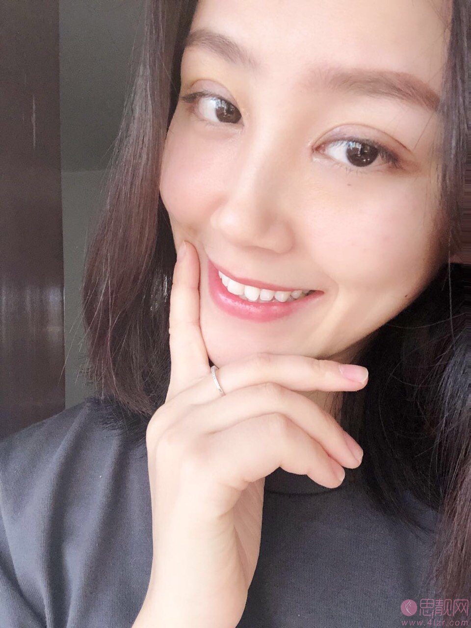 西安华旗唯美门诊部张沙沙做双眼皮手术好不好？2020价格表公布