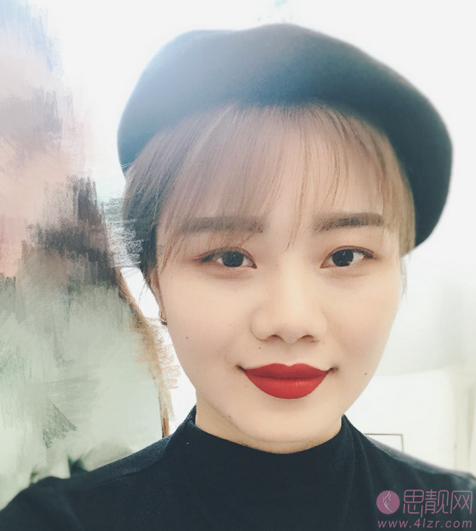 郑州元素美学整形鲁亚东隆鼻怎么样？2020价格表上线+隆鼻真人案例分享