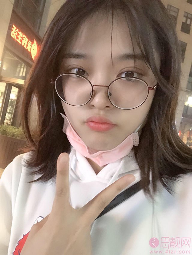 吉林国健美容医院曾蕊做双眼皮怎么样?附双眼皮术后案例一览及2020价格表发布