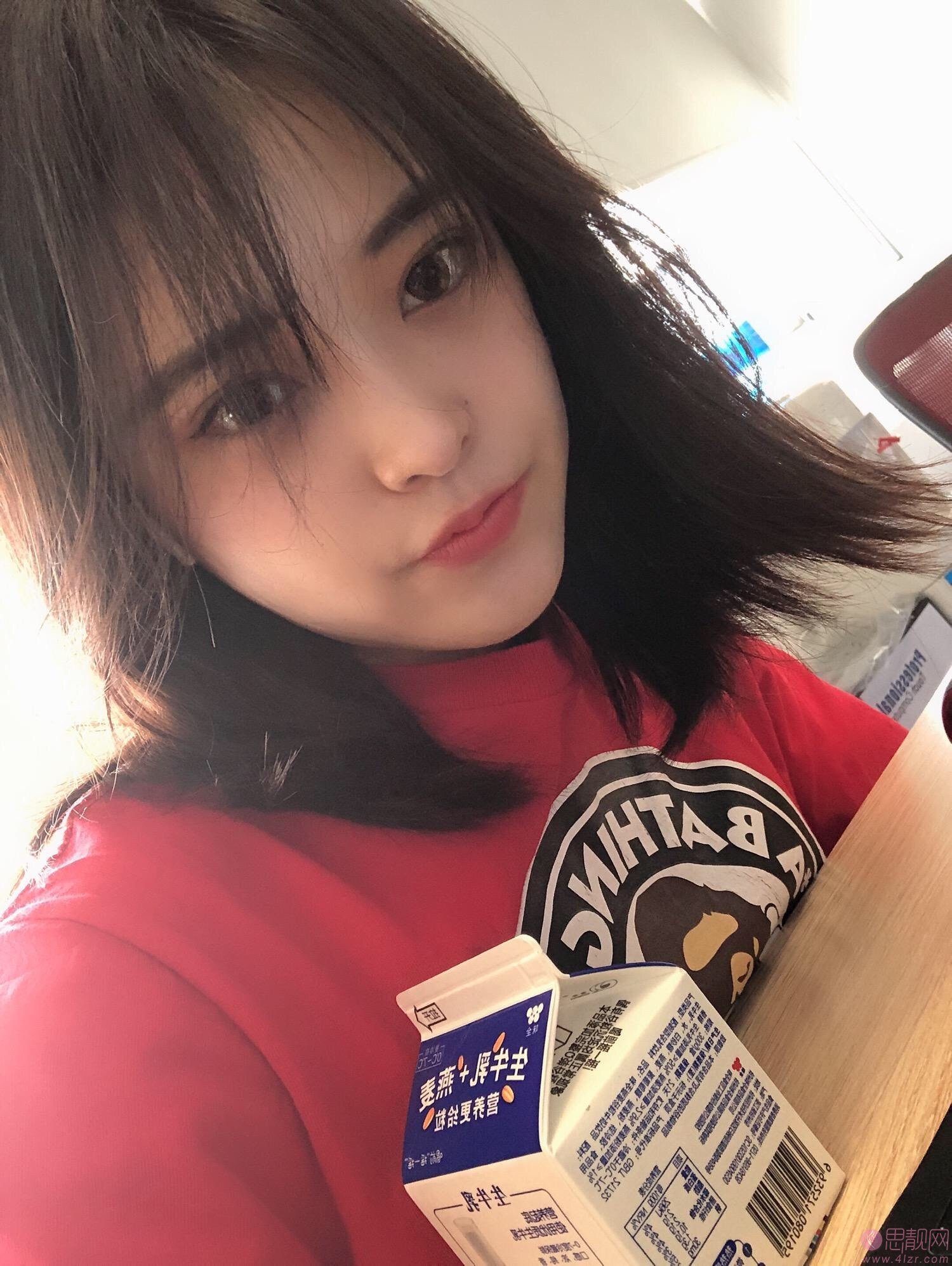 吉林国健美容医院曾蕊做双眼皮怎么样?附双眼皮术后案例一览及2020价格表发布