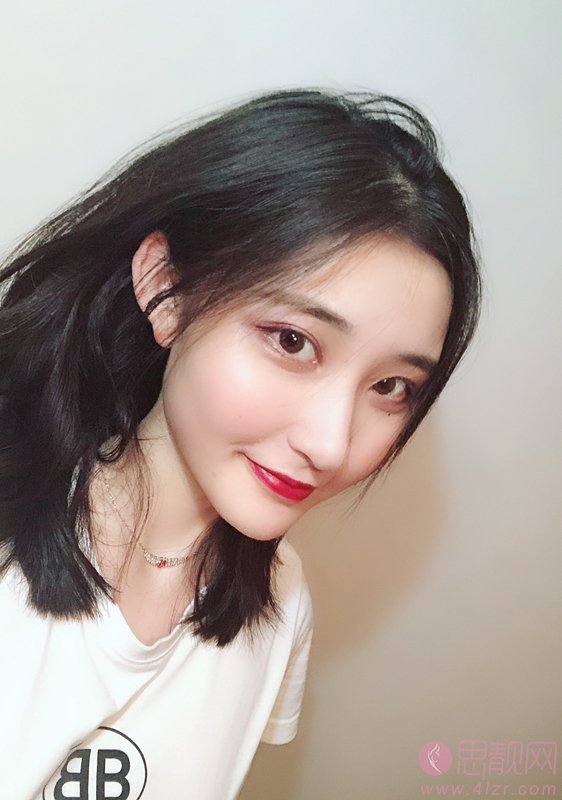 芜湖伊莱美整形外科医院徐世龙隆鼻好不好？2020价格表发布