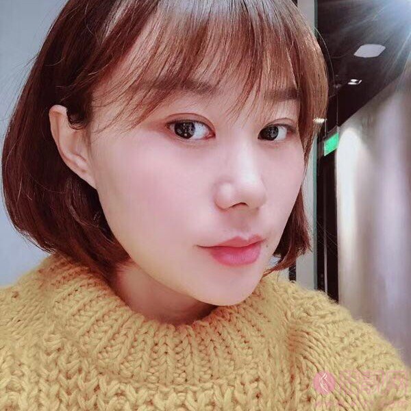 北京为尔医疗美容诊所梁振兴做埋线提升效果怎么样？附提升案例一览及2020价格表公布