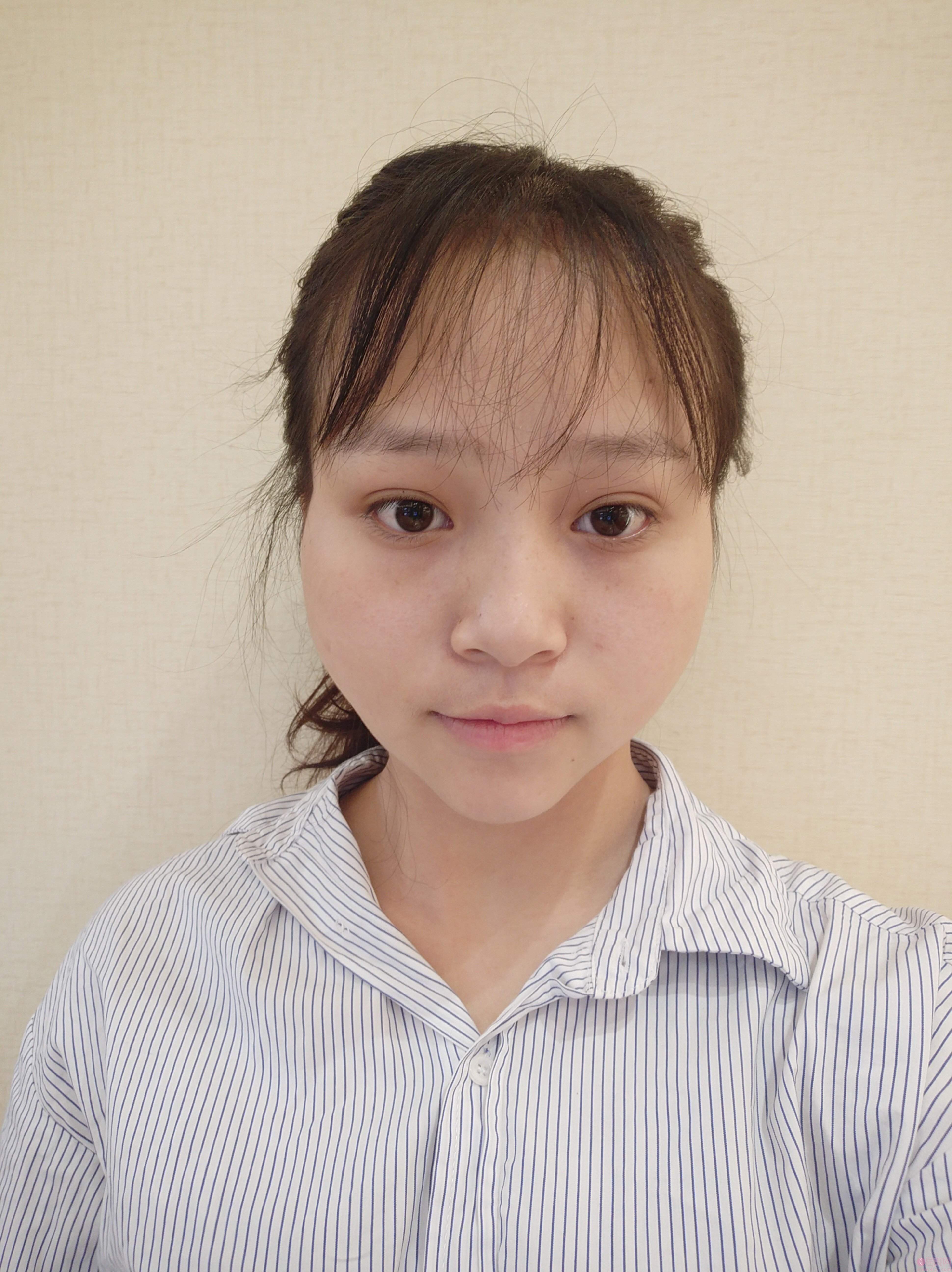 厦门思明薇格整形外科门诊部有限公司张民福自体脂肪丰面颊怎么样？2020价格表曝光